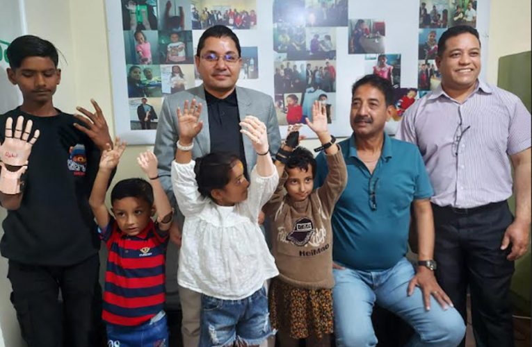 ज्योति विकासद्वारा बालबालिकालाई कृत्रिम हात प्रदान