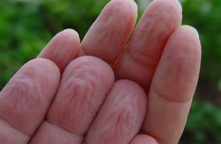 लामो समय पानीमा औँला पर्दा किन चाउरिन्छ ?