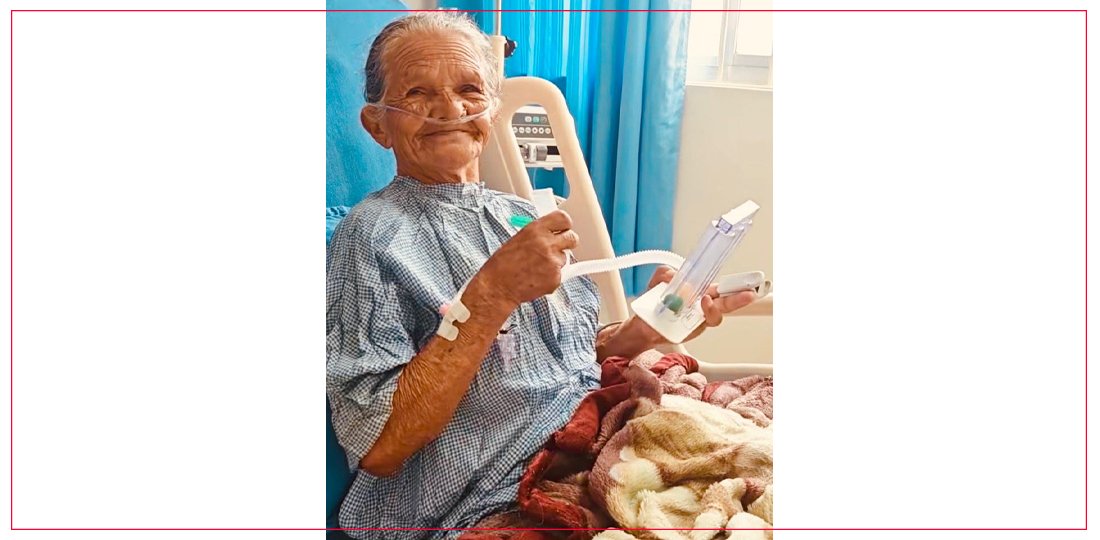 किष्ट अस्पतालमा ८० वर्षीय आमाद्वारा छोरीलाई अङ्गदान